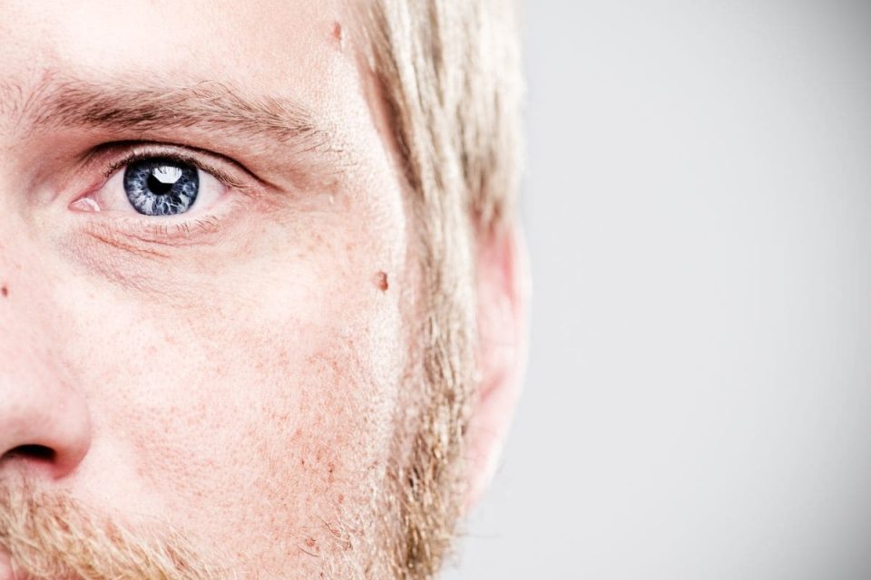 Linkes Auge Zuckt Spirituelle Bedeutung Ein Schlechtes Omen! Lebens Karneval